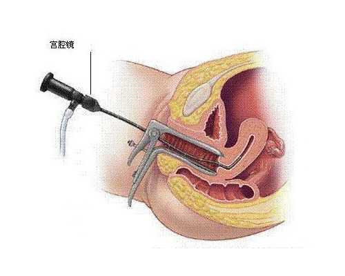 移植3bb囊胚后多久能着床？囊胚移植第五天会着床吗？
