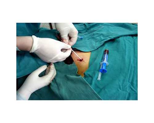 内蒙代孕试管怎么样，2026合法代孕国家排名？附详细介绍？