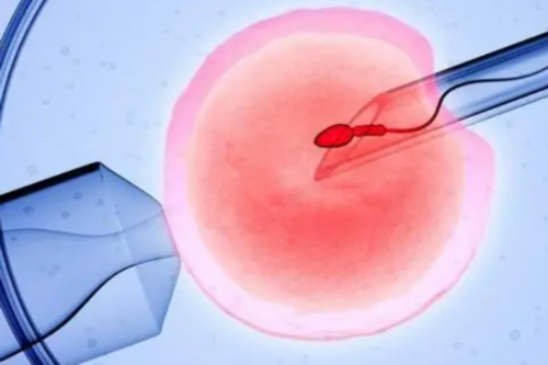 高龄备孕产妇想提升试管婴儿成功率，一定要做到这些