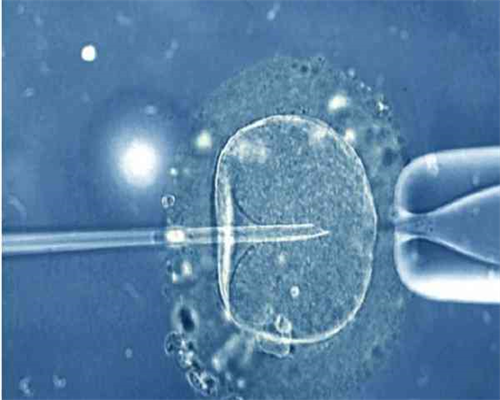 揭示子宫肌瘤的神秘面纱：诊断与防治策略